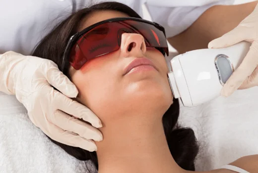 laser-hair-removal face