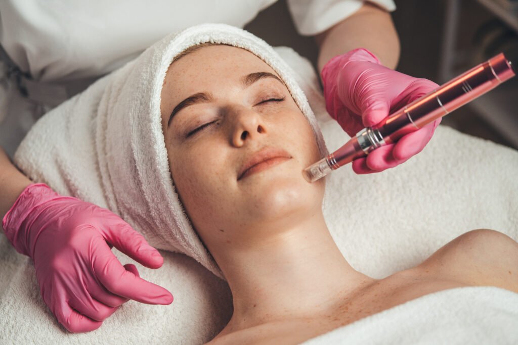 microneedling surrey